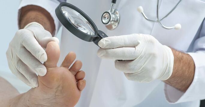 Diagnostické vyšetrenie nechtov na nohách