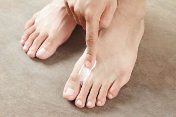 aplikácia masti z huby kože na nohách