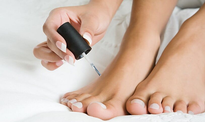 nanášanie laku na nechty na liečbu plesní nechtov na nohách